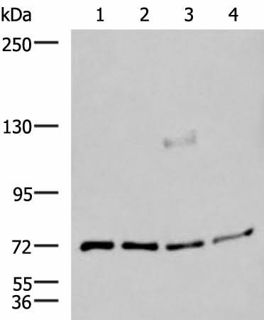 Western blot analysis of A549 A172 TM4 and PC3 cell lysates using ASTE1 Polyclonal Antibody at dilution of 1:600