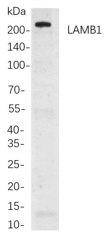 Anti-Human/Mouse/Rat LAMB1 Antibody [B829] - ABMIUM