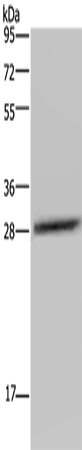 Anti-Human/Mouse/Rat CEBPD Antibody - ABMIUM