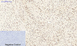 Immunohistochemistry of paraffin-embedded Human uterus tissue using PPARD Monoclonal Antibody at dilution of 1:200.