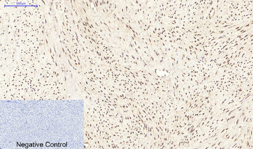 Immunohistochemistry of paraffin-embedded Human uterus tissue using PPARD Monoclonal Antibody at dilution of 1:200.