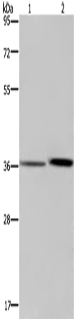 Anti-Human MAGEF1 Antibody - ABMIUM