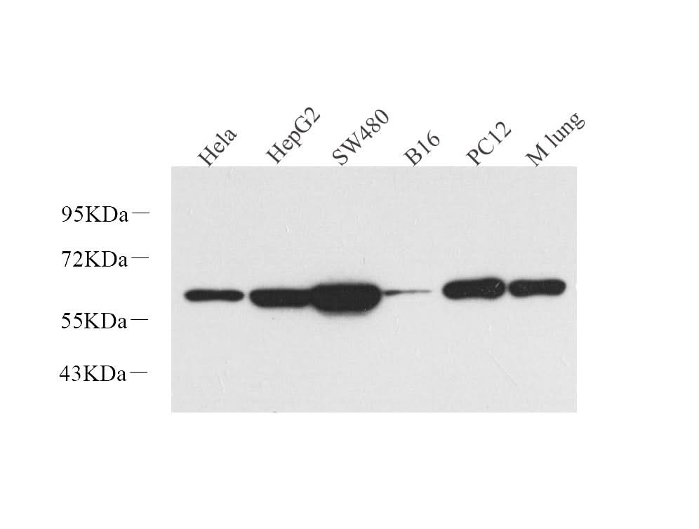 Western Blot analysis of various samples using Vimentin Polyclonal Antibody at dilution of 1:1000.