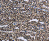 Anti-Human MAGEC1 Antibody - ABMIUM