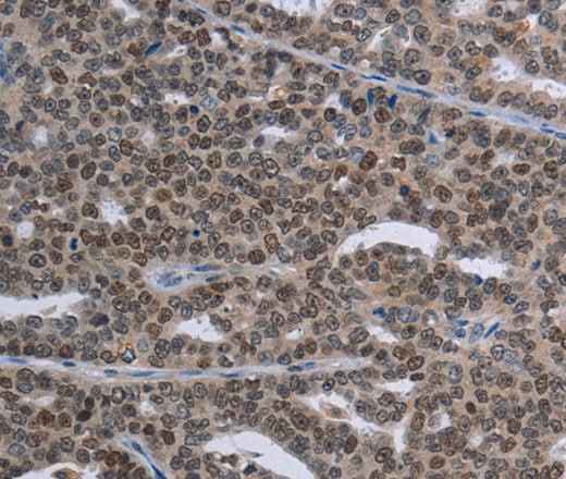 Anti-Human MAGEC1 Antibody