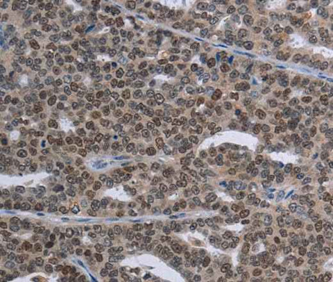 Anti-Human MAGEC1 Antibody