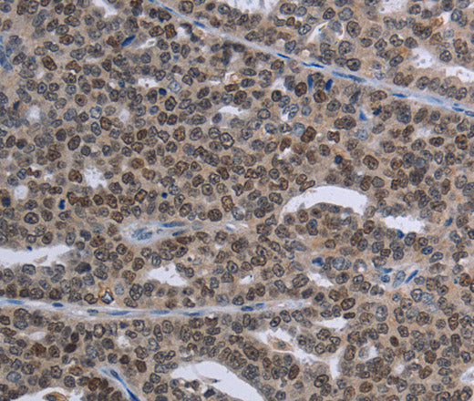 Anti-Human MAGEC1 Antibody - ABMIUM