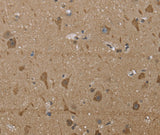 Anti-Human/Mouse/Rat PTK2B Antibody - ABMIUM