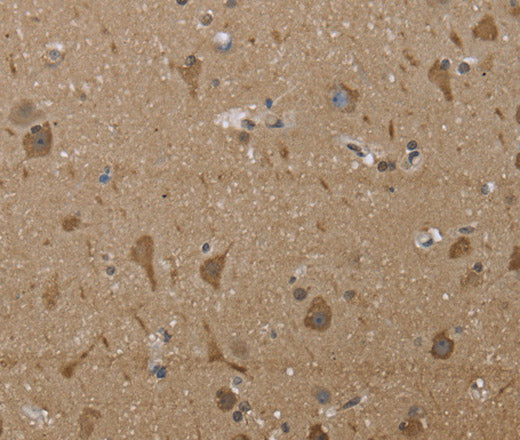 Anti-Human/Mouse/Rat PTK2B Antibody - ABMIUM