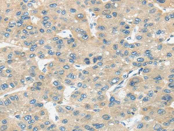 Anti-Human TIRAP Antibody
