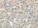 Anti-Human TIRAP Antibody - ABMIUM