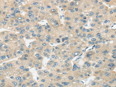 Anti-Human TIRAP Antibody - ABMIUM