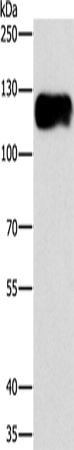 Anti-Human CAST Antibody - ABMIUM
