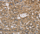 Anti-Human/Mouse/Rat DEGS1 Antibody - ABMIUM