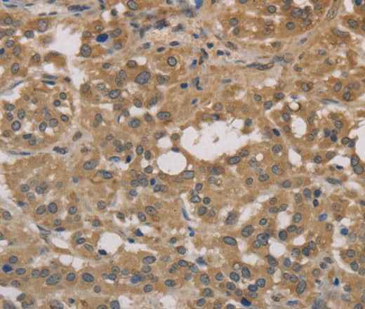 Anti-Human/Mouse/Rat DEGS1 Antibody