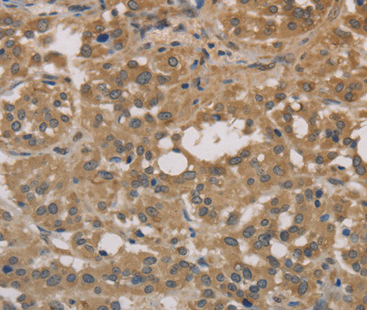 Anti-Human/Mouse/Rat DEGS1 Antibody - ABMIUM