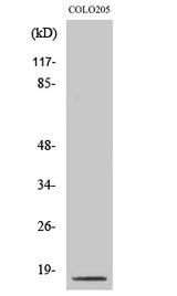 Western Blot analysis of COLO205 cells with Cleaved-CASP3 p17 (D175) Polyclonal Antibody