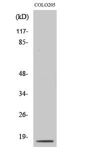 Western Blot analysis of COLO205 cells with Cleaved-CASP3 p17 (D175) Polyclonal Antibody