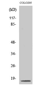 Western Blot analysis of COLO205 cells with Cleaved-CASP3 p17 (D175) Polyclonal Antibody