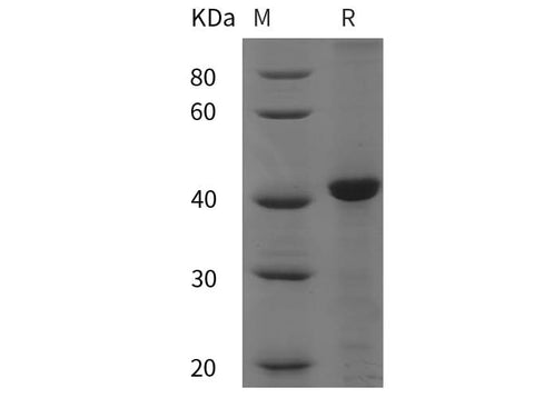 SDS-PAGE analysis of CANX/Calnexin proteins, 2 μg/lane of Recombinant CANX/Calnexin proteins was resolved with SDS-PAGE under reducing conditions, showing bands at 42 kDa.
