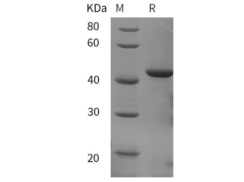 SDS-PAGE analysis of Porcine IL-10 proteins, 2 μg/lane of Recombinant Porcine IL-10 proteins was resolved with SDS-PAGE under reducing conditions, showing bands at 42 kDa.