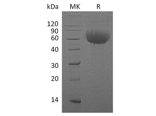Recombinant Human IL13RA1 Protein (His Tag) - ABMIUM
