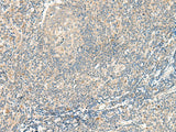 Immunohistochemistry of paraffin-embedded Human tonsil tissue using GPR75 Polyclonal Antibody at dilution of 1:95(×200)