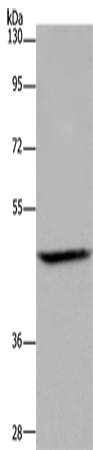 Anti-Human/Mouse ETS2 Antibody - ABMIUM