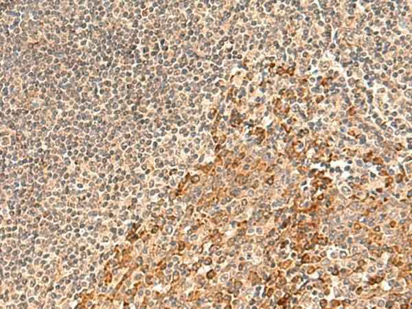 Anti-Human/Mouse GALNT12 Antibody