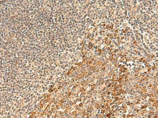 Anti-Human/Mouse GALNT12 Antibody