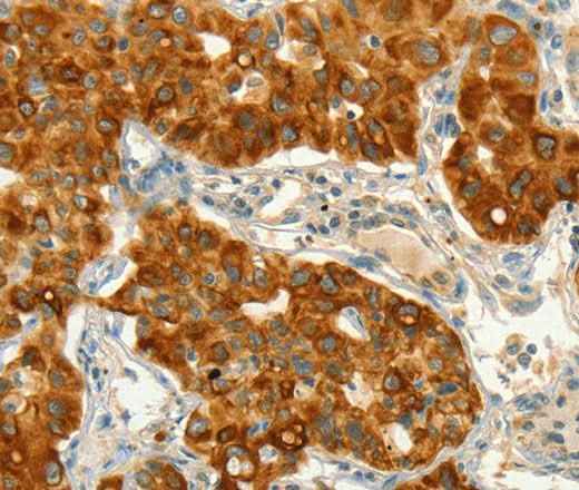 Anti-Human/Mouse/Rat CIB1 Antibody