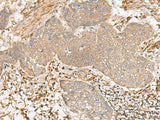 Anti-Human FBXW8 Antibody - ABMIUM