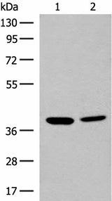 Western blot analysis of K562 and HEPG2 cell lysates using MRM1 Polyclonal Antibody at dilution of 1:400