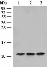 Western blot analysis of Human fetal liver tissue Hela cell HEPG2 cell lysates using ATP5L Polyclonal Antibody at dilution of 1:500