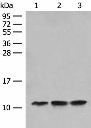 Western blot analysis of Human fetal liver tissue Hela cell HEPG2 cell lysates using ATP5L Polyclonal Antibody at dilution of 1:500