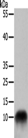 Anti-Human/Rat COX7B Antibody - ABMIUM