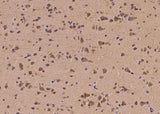 Anti-Human EGR4 Antibody - ABMIUM