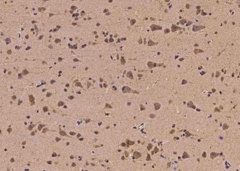 Anti-Human EGR4 Antibody - ABMIUM