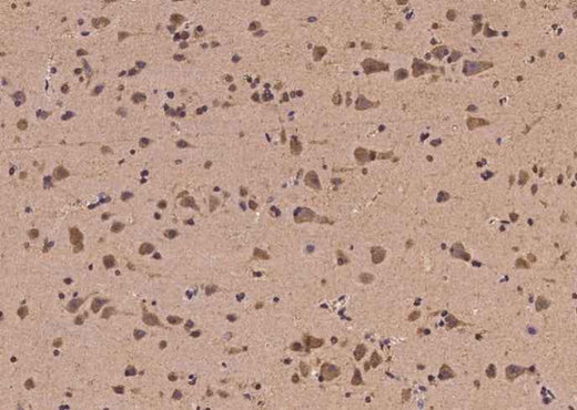 Anti-Human EGR4 Antibody - ABMIUM