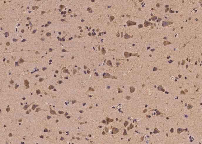 Anti-Human EGR4 Antibody - ABMIUM
