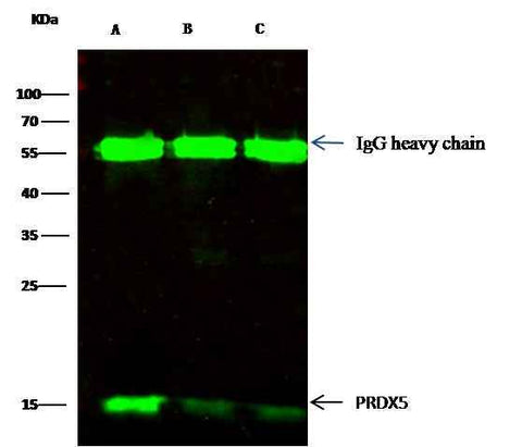 Anti-Human PRDX5 Antibody [B321] - ABMIUM