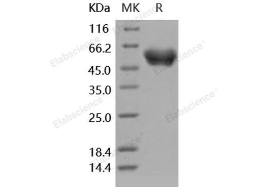 Recombinant Human SerpinA1/A1AT Protein (His Tag) - ABMIUM