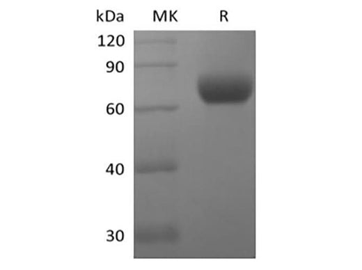 Recombinant Human Natural Killer Cell Receptor 2B4/SLAMF4/CD244 (C-Fc) - ABMIUM