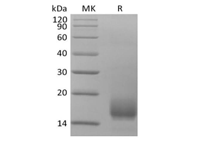 Recombinant Human CD59 (C-6His) - ABMIUM
