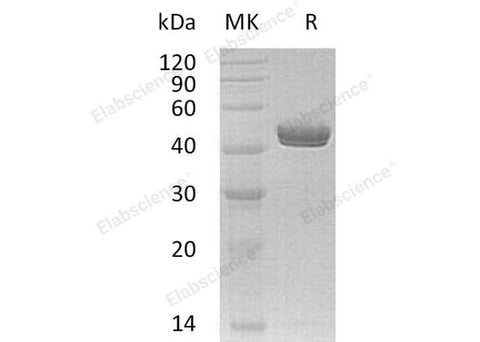 Recombinant Human Netrin-G1/NTNG1 Protein (His Tag) - ABMIUM