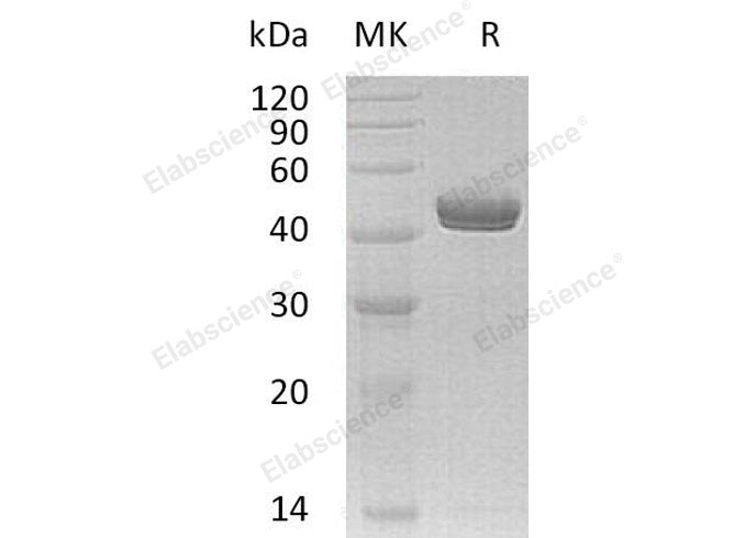Recombinant Human Netrin-G1/NTNG1 Protein (His Tag) - ABMIUM