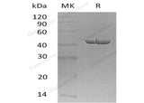 Recombinant Human Carboxypeptidase A1/CPA1 Protein (His Tag) - ABMIUM