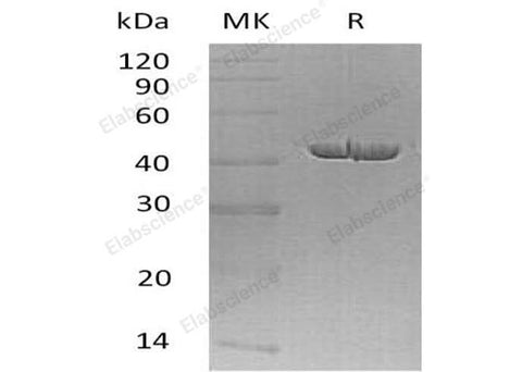 Recombinant Human Carboxypeptidase A1/CPA1 Protein (His Tag) - ABMIUM