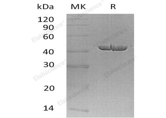 Recombinant Human Carboxypeptidase A1/CPA1 Protein (His Tag) - ABMIUM