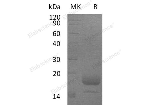 Recombinant Mouse Interleukin-4/IL-4 Protein (His Tag) - ABMIUM